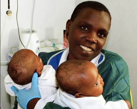 Hospital de Roma separa gêmeas siamesas de 7 meses